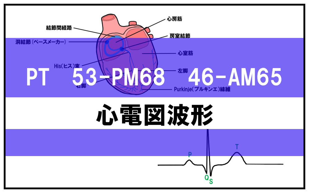 心電図の波形で正しいのはどれか。【第53回理学療法士国家試験PM68】 — 理学療法士国家試験対策PTES