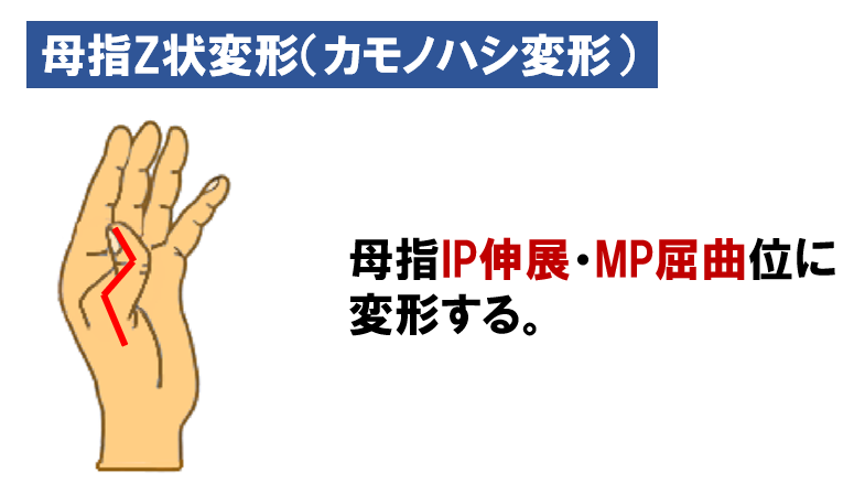 関節リウマチの平均余命